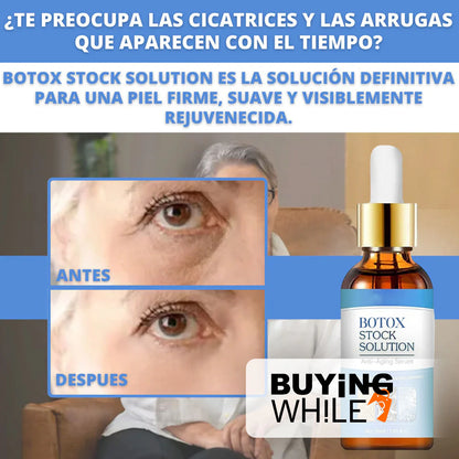 🎁🎁 2 x 1 ENVÍO GRATIS - BOTOX FACIAL PARA ARRUGAS - Bot Solution™